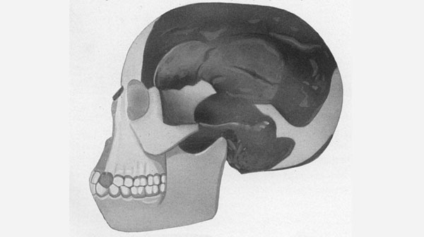 Cranio dell'Uomo di Piltdown.